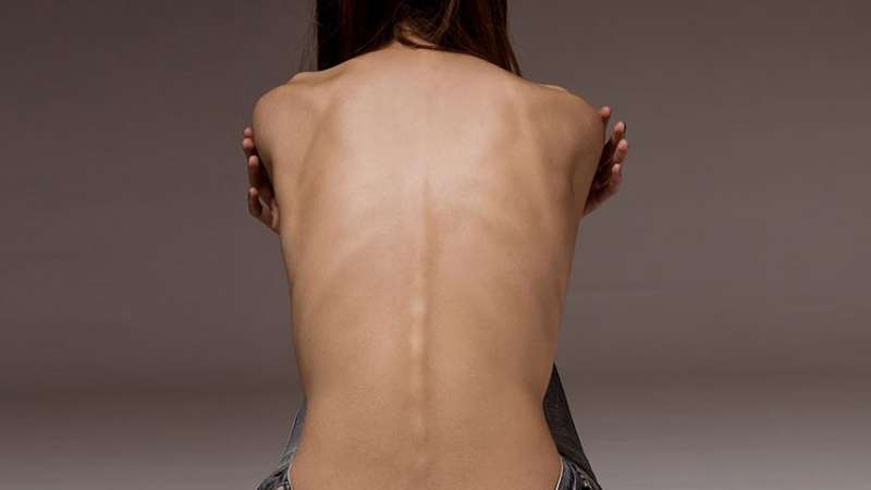 Anorexia nervosa: O papel da mente em distúrbios alimentares Existem aspectos neuropsicológicos que podem influenciar o desenvolvimento de distúrbios alimentares